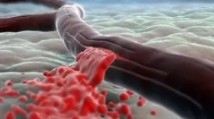 Ko je nevarnost visila na hišnega ljubljenčka: notranja krvavitev pri mačkah